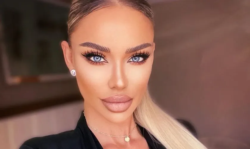 Bianca Drăgușanu, transformare uimitoare după ce și-a scos acidul din buze