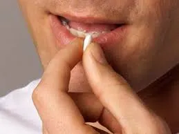 anticonceptionale