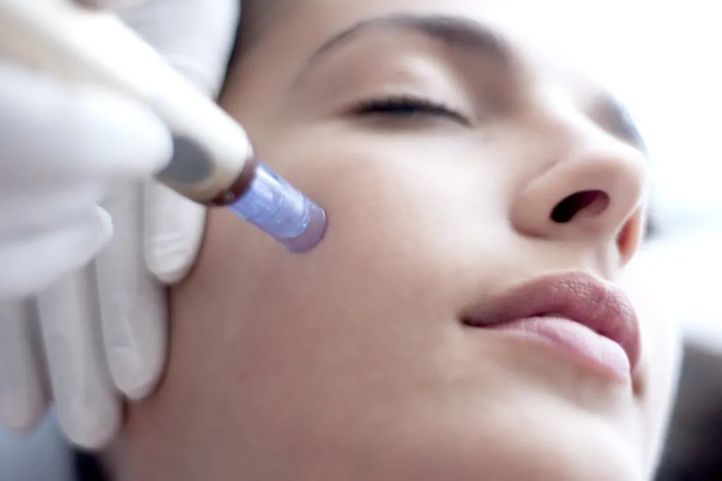 dermapen