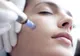 Cum funcționează dermapenul, „stiloul” dermatologiei care înlătură problemele pielii